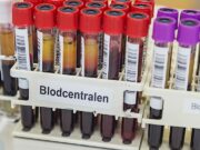 Gabaabsi Dhanka Dhiiga oo ka taagan Dalka Sweden