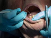 Dowlada Sweden oo kordhisay Waqtiga ilkaha lagu haajinayo