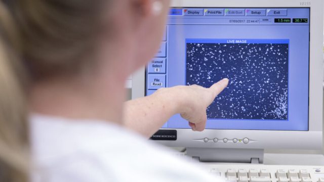 Sædcelle på skjerm ved utredning og behandling med assistert befruktning på Fertilitetsseksjonen ved St. Olavs Hospital Universitetssykehuset i Trondheim.